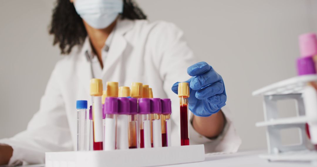 Medical Professional Handling Blood Samples in Laboratory - Free Images, Stock Photos and Pictures on Pikwizard.com