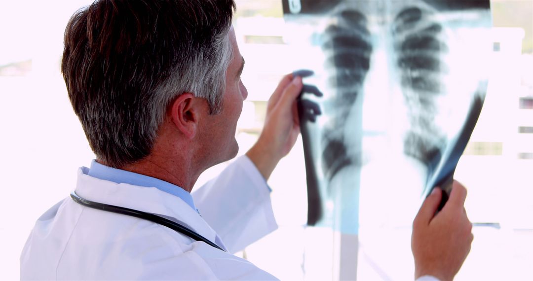 Doctor Examining X-Ray Scan of Patient Lungs in Medical Office - Free Images, Stock Photos and Pictures on Pikwizard.com