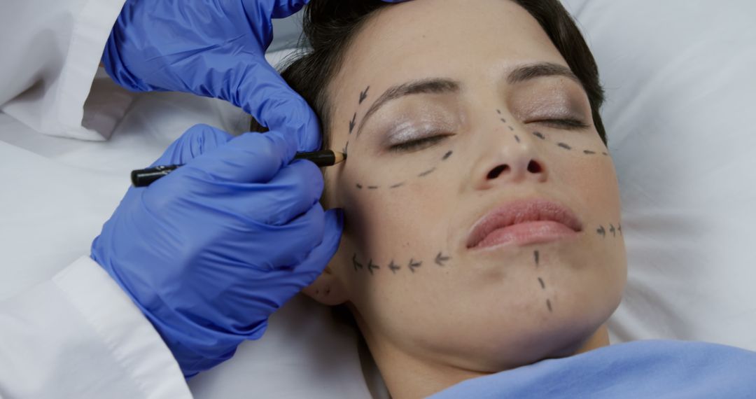 Woman Preparing for Cosmetic Surgery with Markings on Face - Free Images, Stock Photos and Pictures on Pikwizard.com