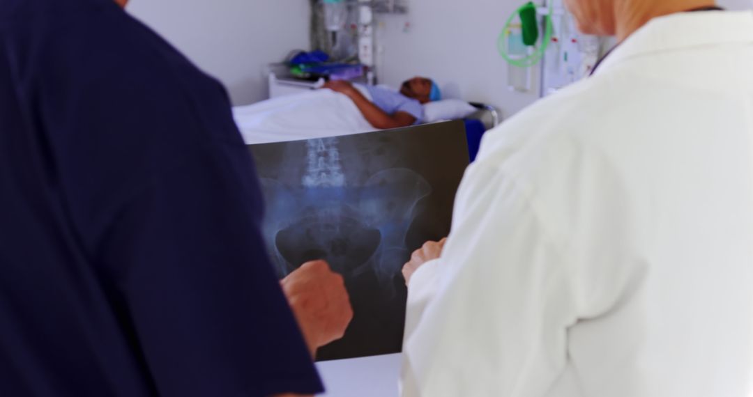 Doctors Examining X-Ray of Patient in Hospital Room - Free Images, Stock Photos and Pictures on Pikwizard.com