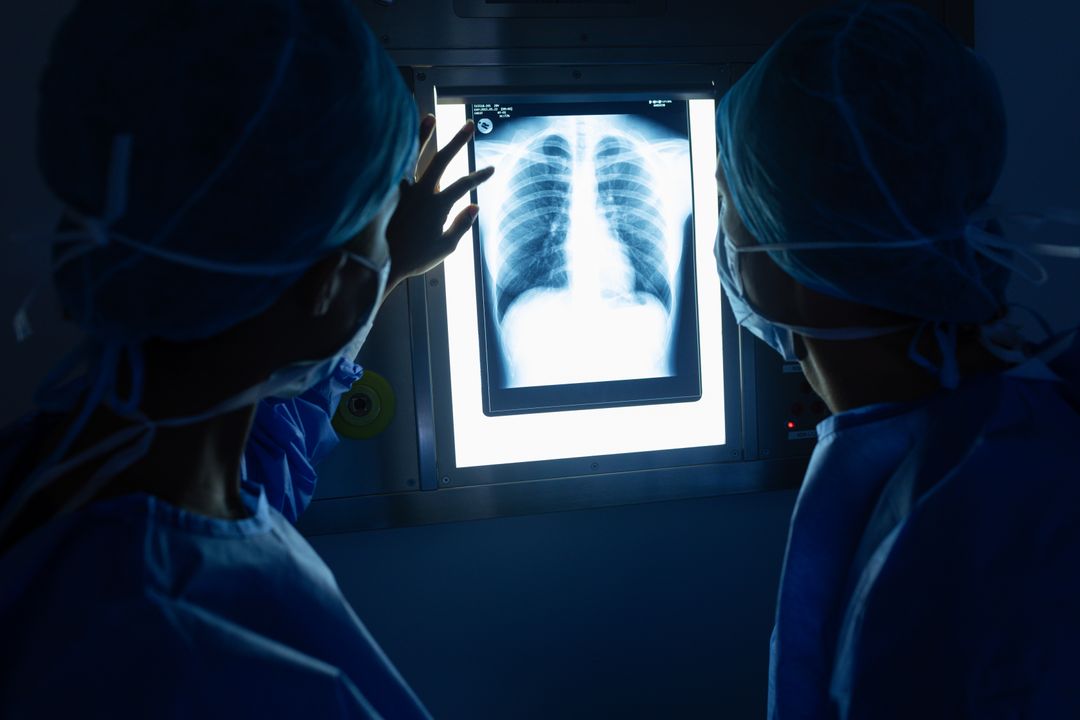 Surgeons Analyzing Chest X-Ray in Operating Room - Free Images, Stock Photos and Pictures on Pikwizard.com