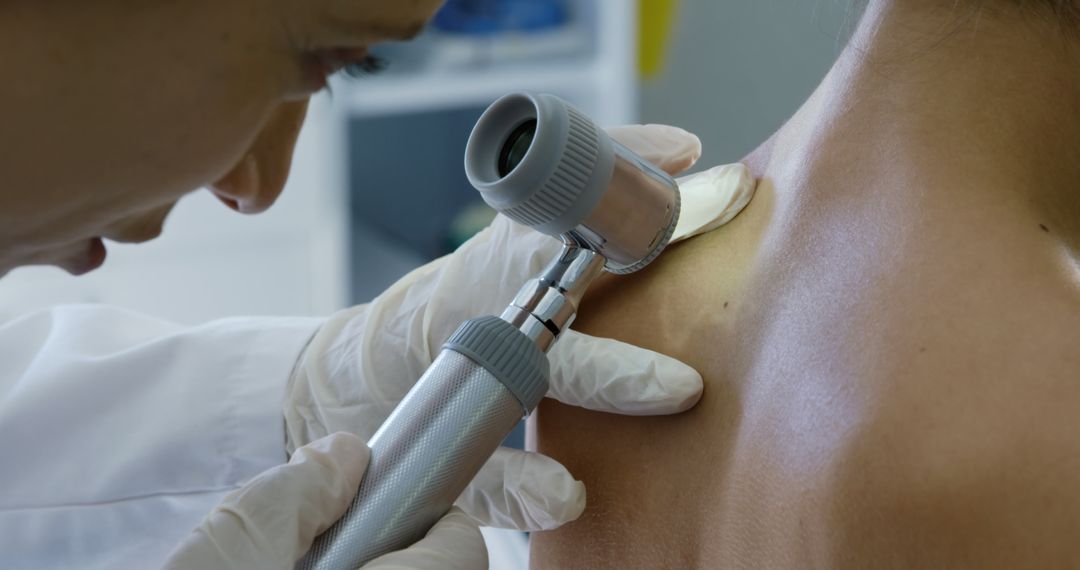 Dermatologist Examining Skin with Dermatoscope for Diagnosis - Free Images, Stock Photos and Pictures on Pikwizard.com