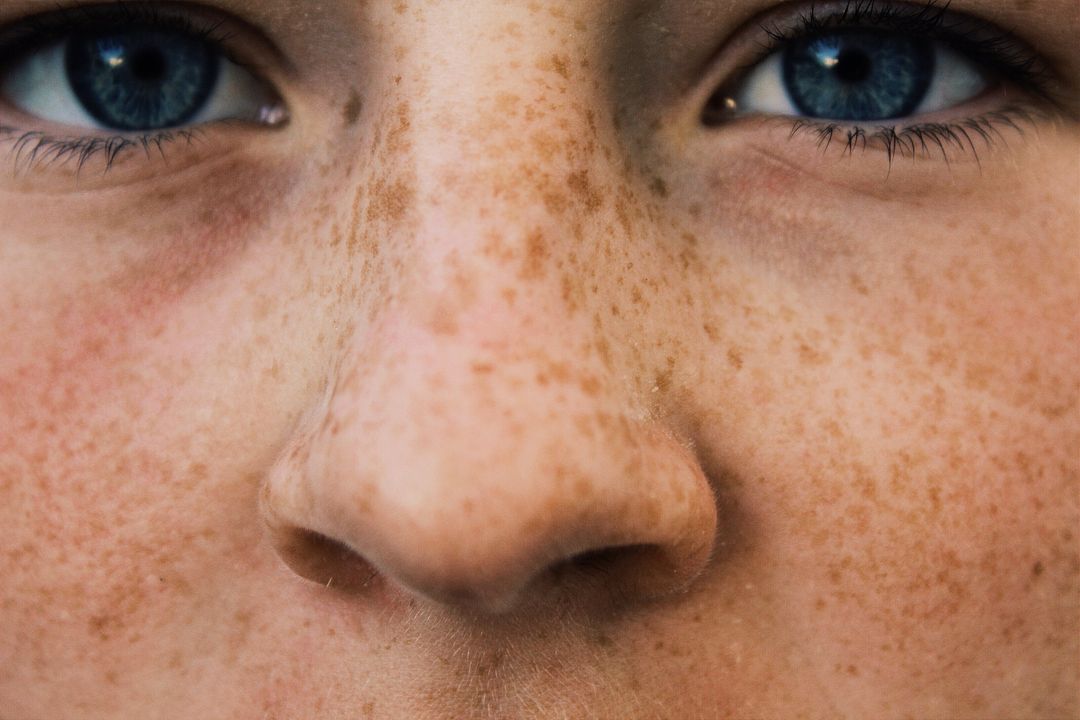 Close-Up of Freckles and Blue Eyes - Free Images, Stock Photos and Pictures on Pikwizard.com