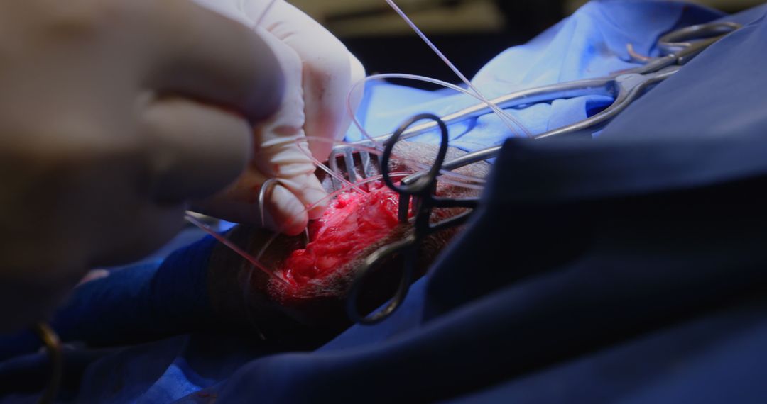 Veterinarian Performing Surgery on Dog in Operating Theater