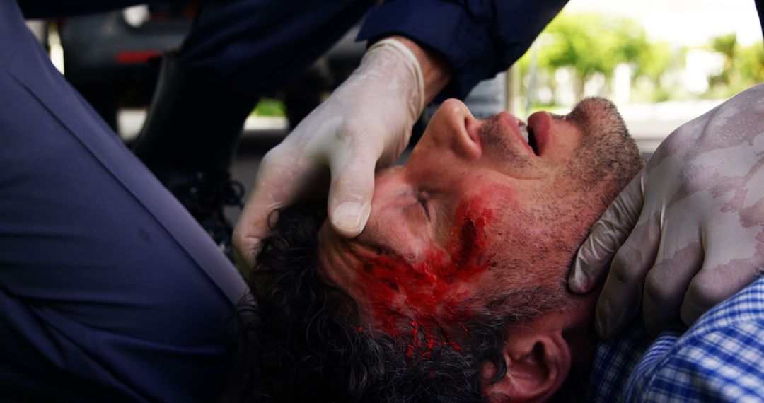 Paramedic Assisting Injured Man with Head Trauma Emergency Situation - Free Images, Stock Photos and Pictures on Pikwizard.com