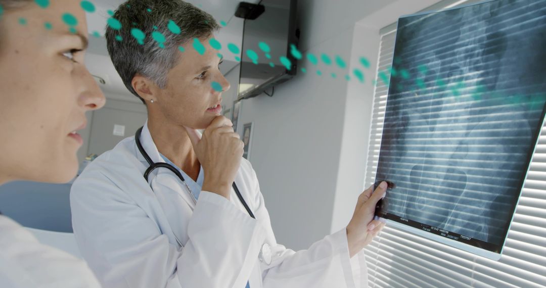 Senior Physician Reviewing Chest X-ray Film with Colleague During Clinical Consultation