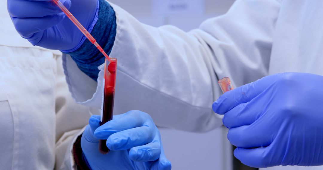 Scientists Testing Blood Samples with Droppers in Laboratory - Free Images, Stock Photos and Pictures on Pikwizard.com