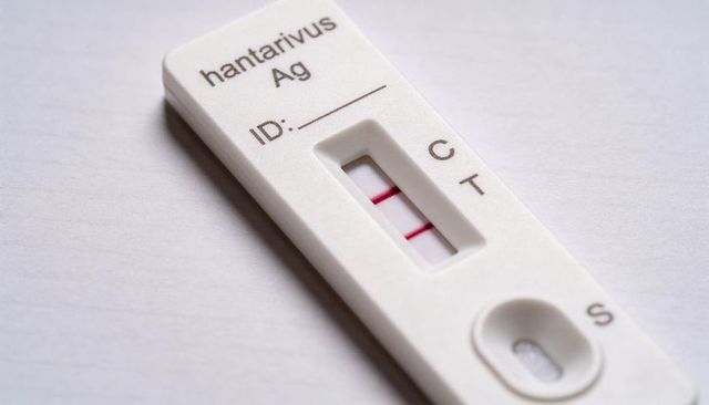 Hantavirus ag rapid lateral-flow test cassette showing positive double-line result