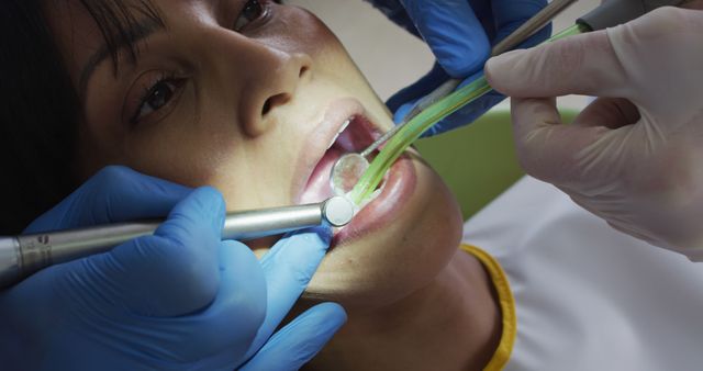 Close-up of Patient Receiving Dental Treatment from Dentist - Download Free Stock Images Pikwizard.com