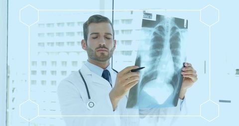 Doctor examining chest x-ray with pen, reviewing lungs in bright hospital clinic