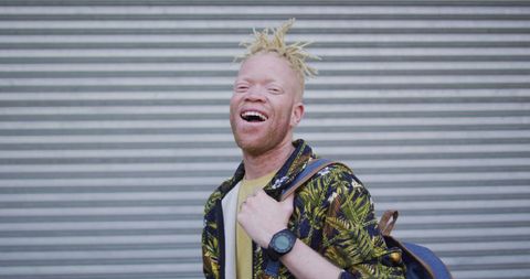 Smiling Albino African American Man with Dreadlocks