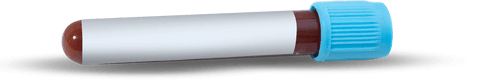 Transparent Test Tube with Blood Sample and Blue Cap Close-Up - Download Free Stock Videos Pikwizard.com