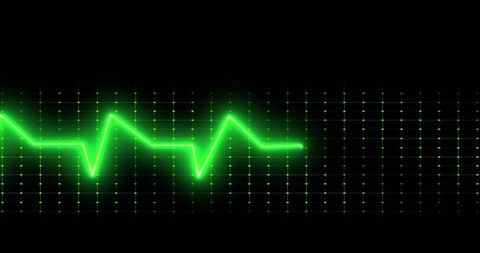 Digital Green EKG Heartbeat on Black Background