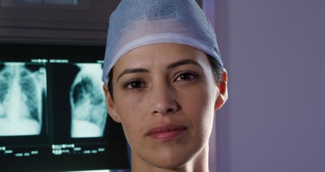 Female doctor appearing serious with x-ray images in background. Useful for themes in healthcare, medical expertise, hospital environment, and professional concentration. Ideal for use in medical articles, hospital promotions, healthcare websites, and educational materials.