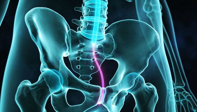 Neon Translucent Pelvis and Lumbar Spine with Magenta Spinal Tube Medical Illustration