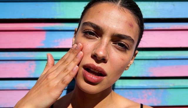 Young woman touching cheek and showing freckles and forehead mark on pastel shutter