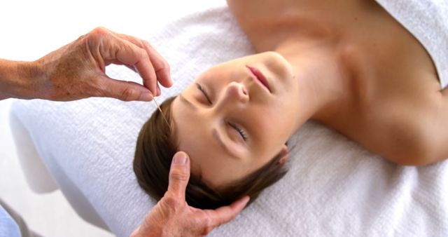 Woman Receiving Acupuncture Treatment on Forehead - Download Free Stock Images Pikwizard.com