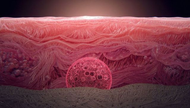 Porous spherical cell embedded in layered fibrous tissue cross-section, magenta glow
