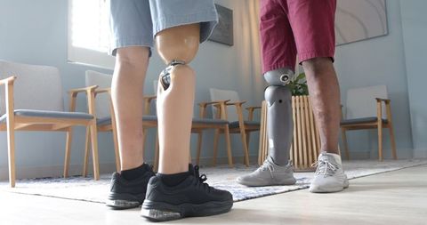 Seniors with Prosthetic Limbs Discussing Therapy Progress in Clinic