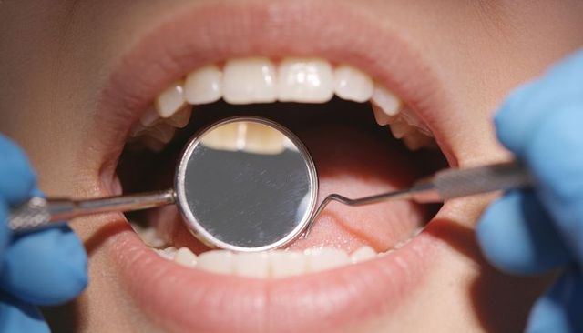 Close-up dentist examining open mouth using mirror and explorer during routine dental check