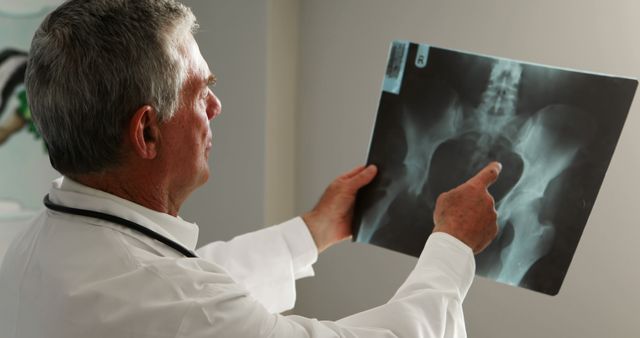 Doctor in white coat analyzing x-ray film of pelvic region in a hospital setting. Suitable for medical and healthcare content, articles about radiology, professional healthcare services, or educational materials about anatomy and diagnostics.