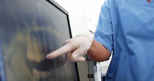 Medical Professional Pointing at Dental X-Ray on Screen in Clinic - Download Free Stock Images Pikwizard.com