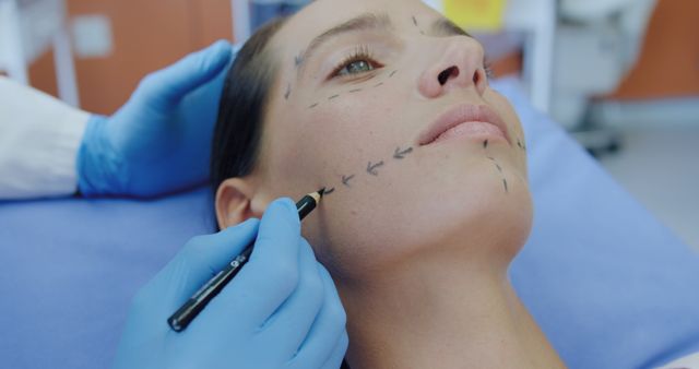 Preparing for Cosmetic Surgery with Facial Markings on Woman's Cheek - Download Free Stock Images Pikwizard.com