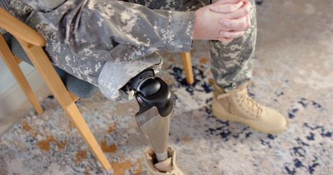 Wounded veteran with prosthetic leg in uniform showing resilience