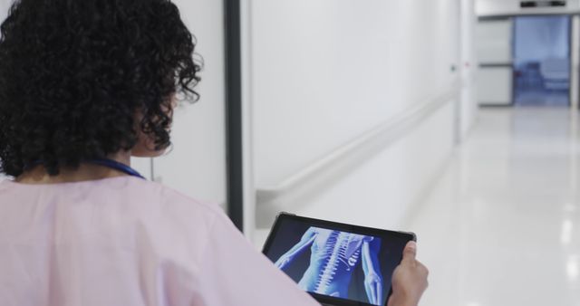 Image shows healthcare worker analyzing x-ray on tablet in hospital corridor. Useful for medical technology, healthcare industry advertisements, or illustrating remote diagnostics or telemedicine.
