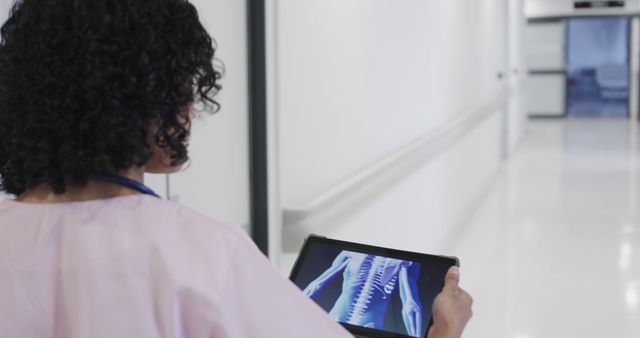 Medical Professional Viewing X-Ray on Tablet in Hospital Corridor - Download Free Stock Images Pikwizard.com