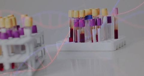 Blood collection tubes in laboratory rack with dna helix overlay for diagnostic research