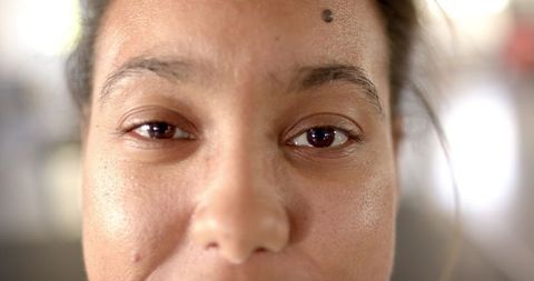 Close-up of Woman Relaxing During Rehabilitation Therapy