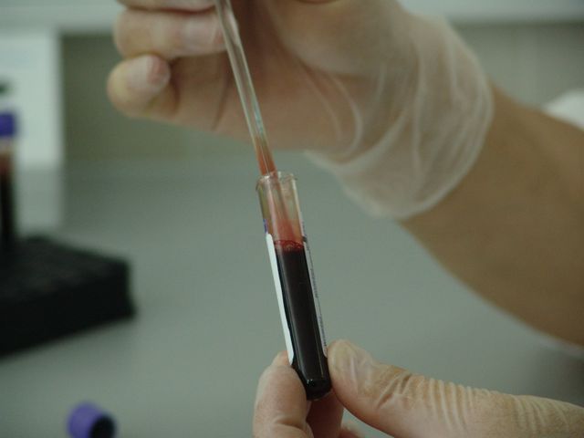 Scientist Working with Blood Sample in Laboratory - Download Free Stock Photos Pikwizard.com