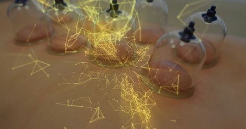 Cupping therapy with futuristic digital overlay illustrating healing