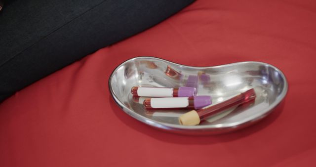 Blood Samples in Tray on Red Surface during Medical Procedure - Download Free Stock Images Pikwizard.com