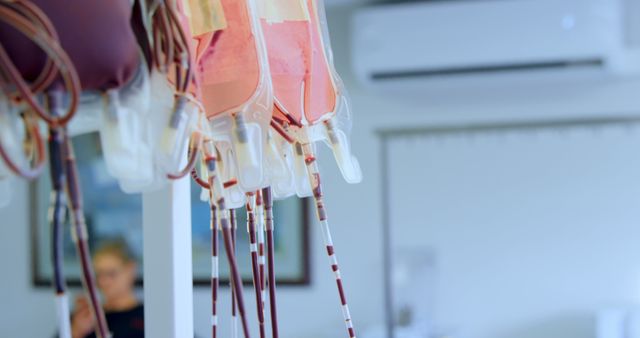 Close-up of blood and plasma bags hanging in a medical facility. Useful for illustrating healthcare settings, medical procedures, emergency care, and lifesaving services. Ideal for educational materials, medical presentations, and healthcare-related marketing.