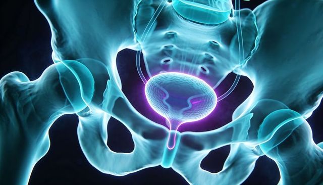 Glowing urinary bladder within pelvic skeleton highlighting ureters, hip bones, sacrum