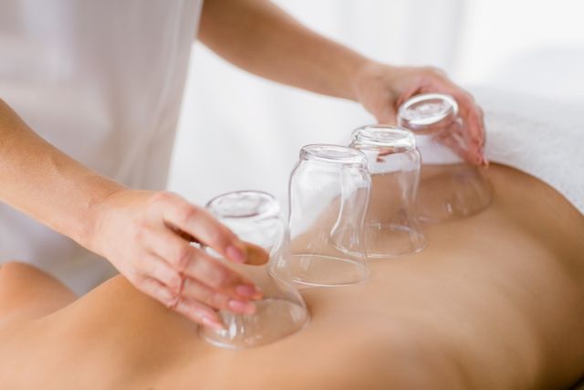 Therapist placing glass cups on woman's back for cupping therapy. Ideal for illustrating alternative medicine practices, wellness and relaxation concepts, spa services, and holistic healing methods.