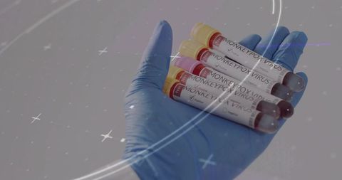 Gloved hand holding monkeypox virus blood tubes in clinical laboratory