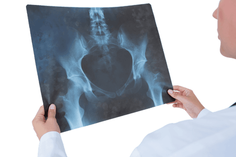 doctor examining transparent x-ray film of pelvic area - Download Free Stock Videos Pikwizard.com