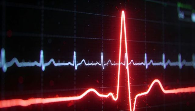Neon ecg waveform pulsing bright red cardiac spike over cyan baseline on dark grid