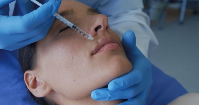 Close-up depicts a patient receiving a cosmetic injection, potentially a dermal filler, from a medical professional wearing blue gloves. This can be used in articles on cosmetic treatments, healthcare, dermatology practices, aesthetic enhancements, beauty tips, or self-care routines.