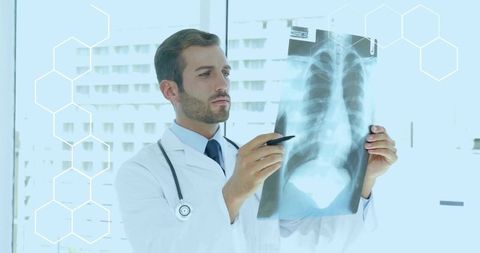Doctor examining chest x-ray pointing with pen stethoscope medical radiology consult