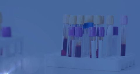 Clinical laboratory blood test tubes on rack