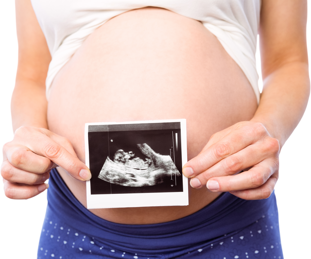 Pregnant Woman Holding Ultrasound Scan On Transparent Background - Download Free Stock Videos Pikwizard.com