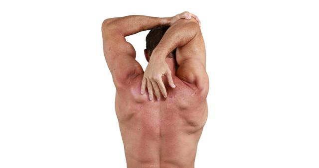 A Caucasian man appears with a sunburn on his back, indicating a need for proper skin protection. His posture suggests he might be experiencing discomfort or applying after-sun care to alleviate the burn.