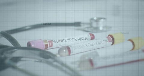 Laboratory test tubes with monkeypox virus sample and stethoscope