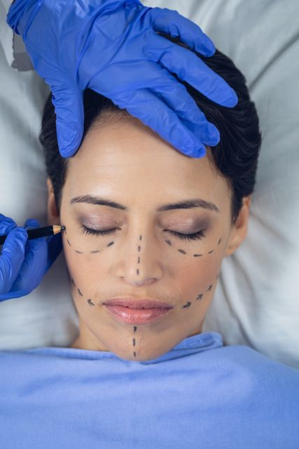 Surgeon marking woman face before surgery in operating room - Download Free Stock Photos Pikwizard.com