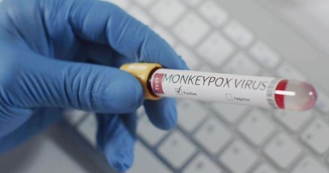 Gloved hand holding monkeypox positive blood specimen tube with yellow cap on lab keyboard