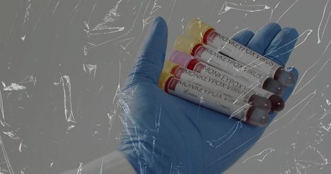 Gloved Hand Holding Monkeypox Virus Test Tubes with Clear Protective Film Overlay